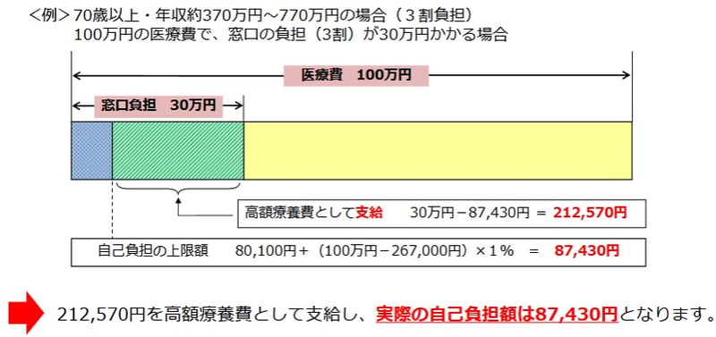 高額療養費制度「70歳以上・年収約370万円～770万円の場合（３割負担）」