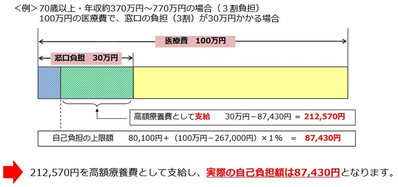 高額療養費制度「70歳以上・年収約370万円～770万円の場合（３割負担）」