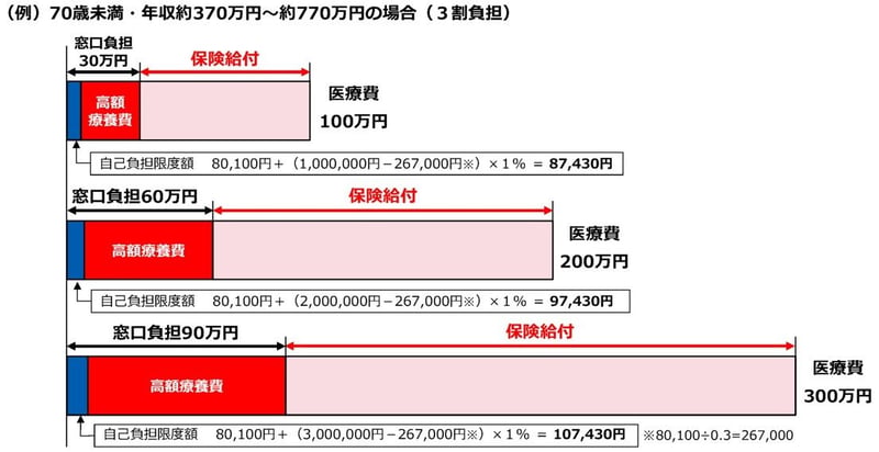 自己負担の仕組み